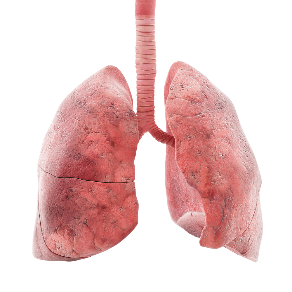 Die Lunge im Inneren des Brustkorbs in der Ansicht von vorn